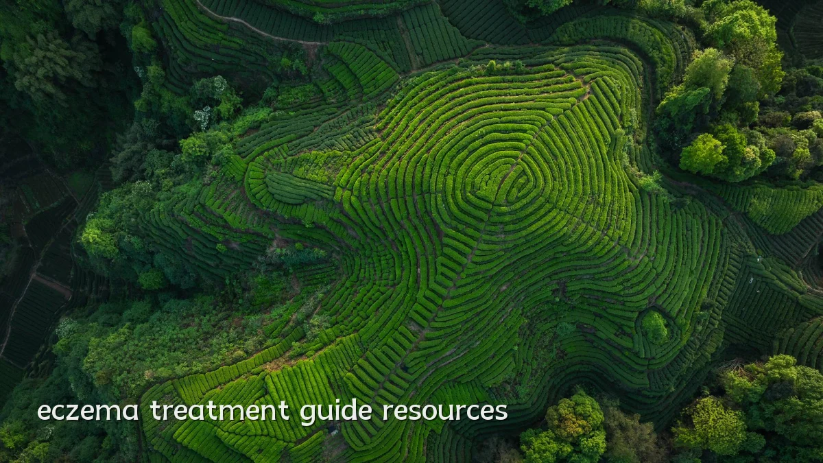 eczema treatment guide resources