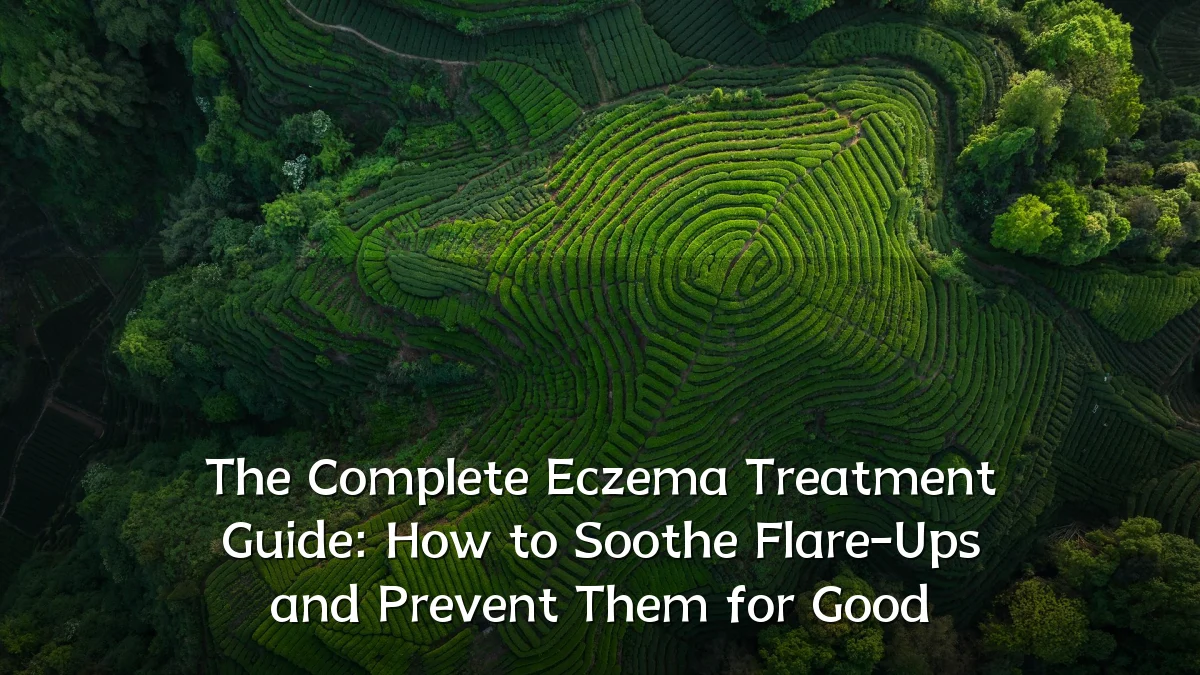The Complete Eczema Treatment Guide: How to Soothe Flare-Ups and Prevent Them for Good